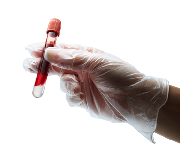 Blood test sample